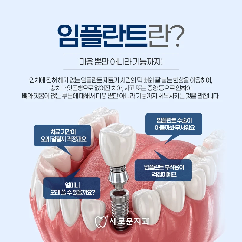 새로운치과의 임플란트 구조와 치료 안내 이미지